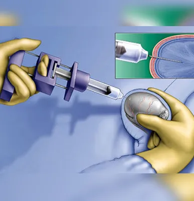Service Image